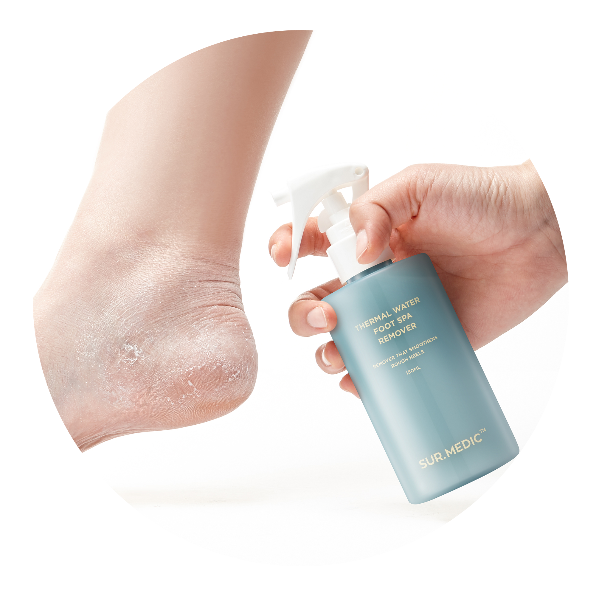 SUR.MEDIC+ THERMAL WATER FOOT SPA REMOVER 150ML